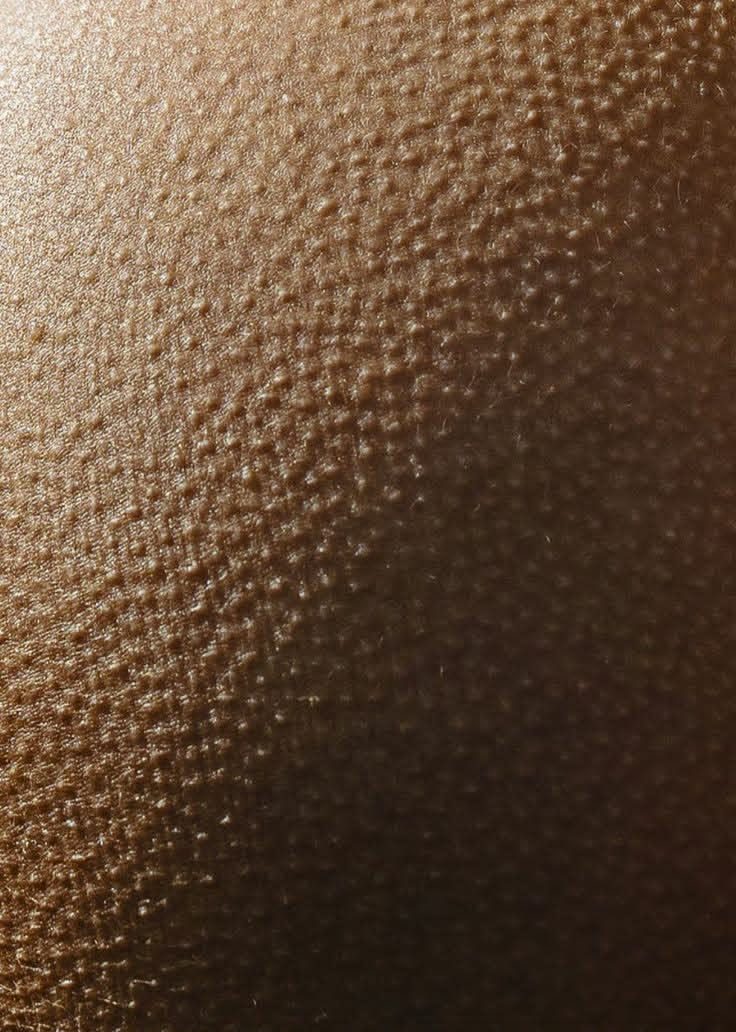 Gros plan sur une peau parcourue de frissons